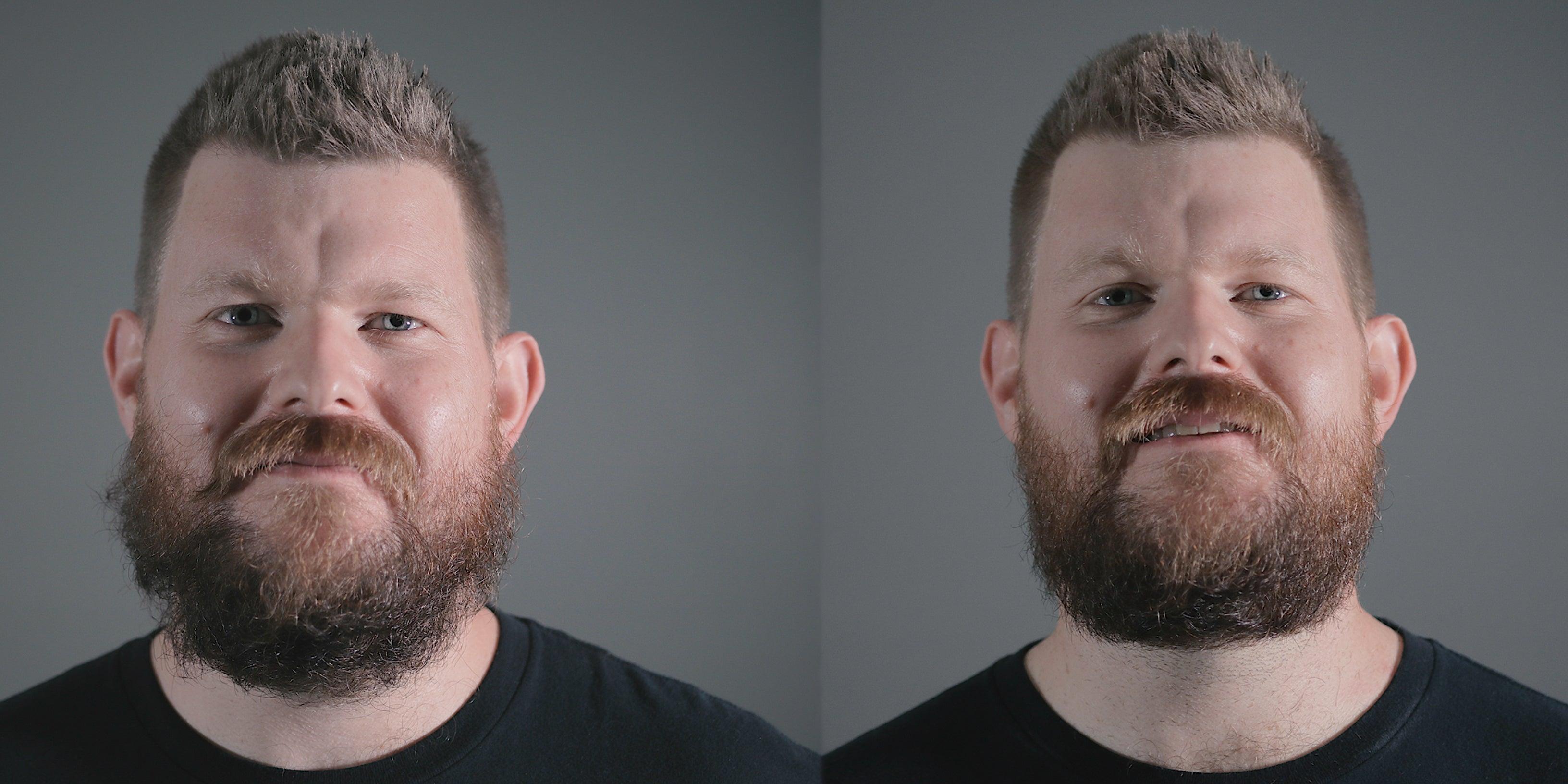 Before and after beard trim